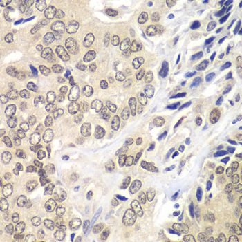 Immunohistochemistry - RNF2 Polyclonal Antibody (144-05563)