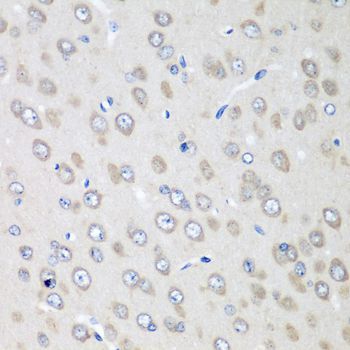 Immunohistochemistry - RPN2 antibody (144-08352)