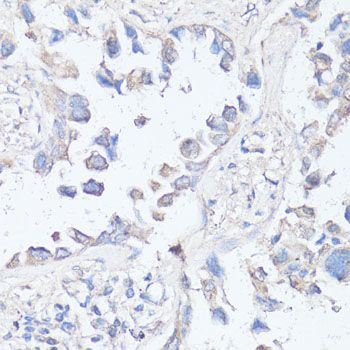 Immunohistochemistry - MTOR antibody (144-11355)