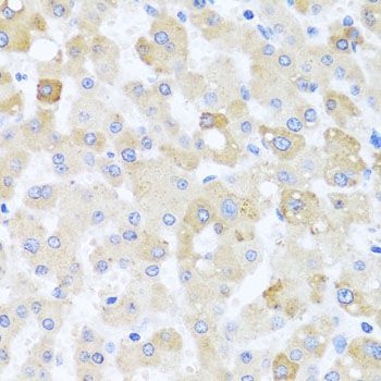 Immunohistochemistry - CETN1 antibody (144-03784)