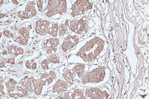 Immunohistochemistry - MAP1LC3B Polyclonal Antibody (144-07198)