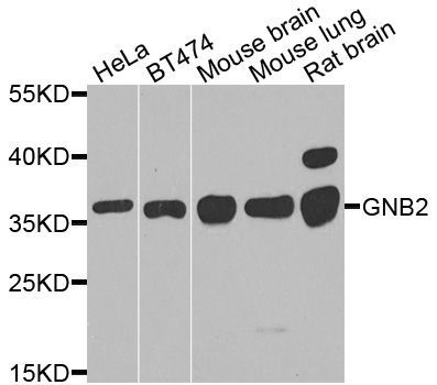 Western blot - GNB2 antibody (144-08422)