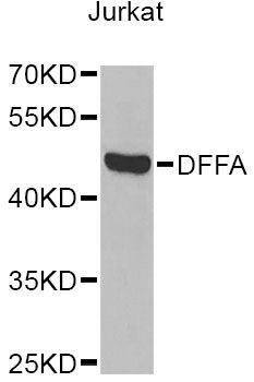 Western blot - DFFA Antibody (144-012431)