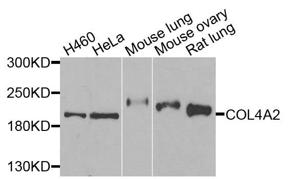 Western blot - COL4A2 antibody (144-07657)