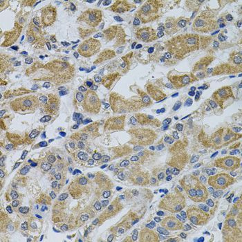 Immunohistochemistry - PTK7 antibody (144-09839)