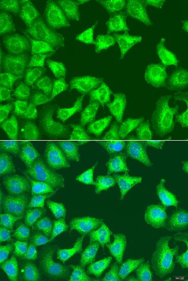 Immunohistochemistry - SQSTM1 Polyclonal Antibody (144-011483)