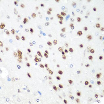 Immunohistochemistry - CDK1 antibody (144-012414)