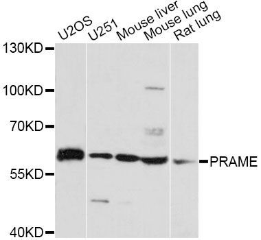 Western blot - PRAME antibody (144-60684)