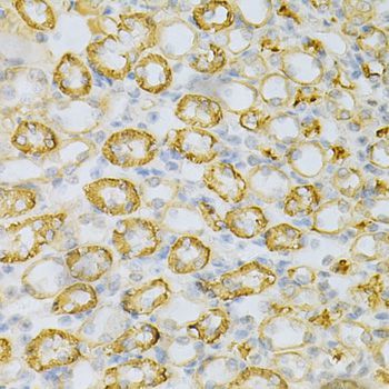 Immunohistochemistry - CDC42 Antibody (144-01188)