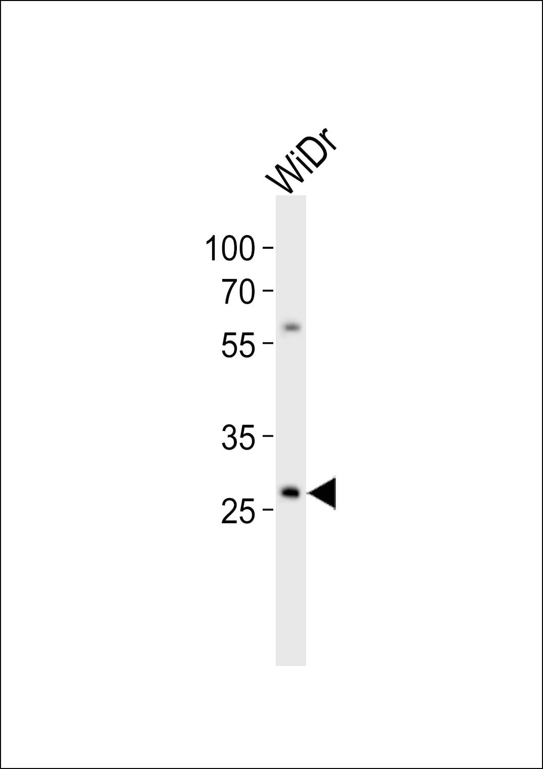 WB
