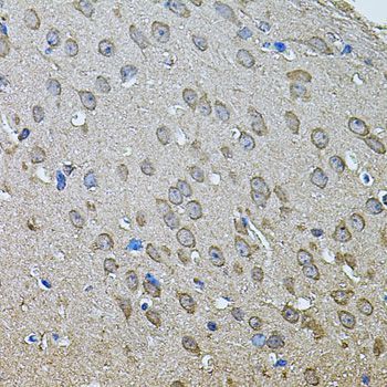 Immunohistochemistry - ANXA8L2 antibody (144-07641)