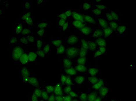 Immunofluorescence - FGF14 antibody (144-06588)