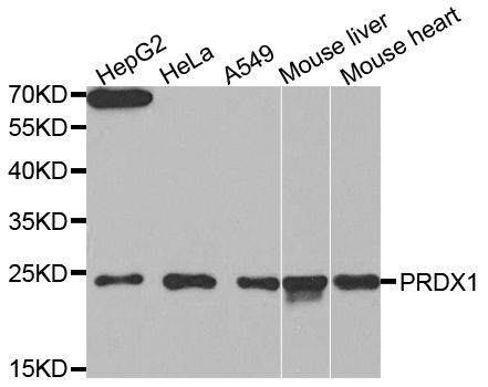 Western blot - PRDX1 Polyclonal Antibody (144-60374)