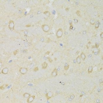 Immunohistochemistry - TRAP1 Antibody (144-02748)