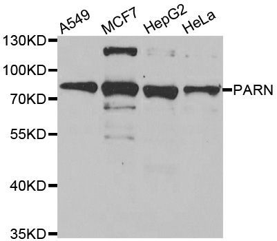 Western blot - PARN Polyclonal Antibody (144-06941)