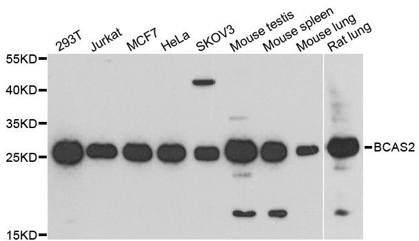 Western blot - BCAS2 Polyclonal Antibody (144-04398)