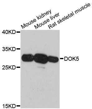 Western blot - DOK5 antibody (144-60464)