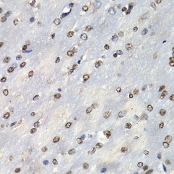 Immunohistochemistry - PSMB10 antibody (144-05452)