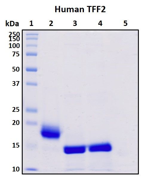 SDS-PAGE