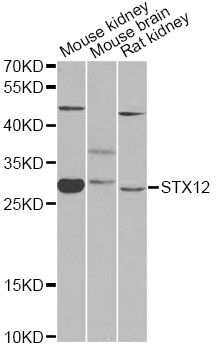 Western blot - STX12 antibody (144-08200)