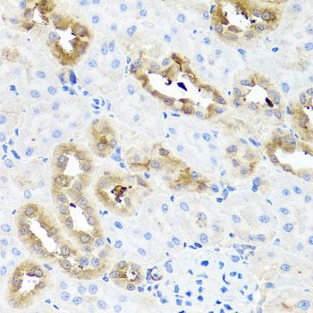 Immunohistochemistry - FABP5 Polyclonal Antibody (144-00947)