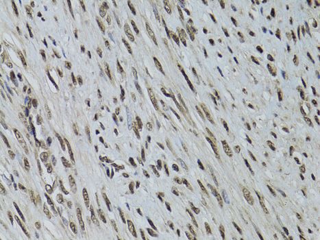 Immunohistochemistry - STK11 antibody (144-02122)