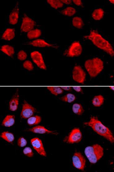 Immunofluorescence - CBS Polyclonal Antibody (144-01427)