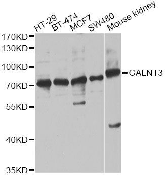 Western blot - GALNT3 antibody (144-60539)