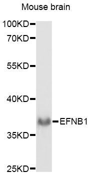 Western blot - EFNB1 antibody (144-60709)