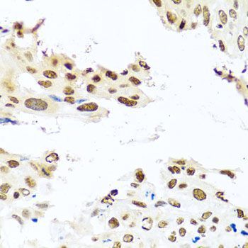 Immunohistochemistry - RAB3IP Polyclonal Antibody (144-08094)
