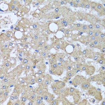 Immunohistochemistry - DCP2 antibody (144-08282)