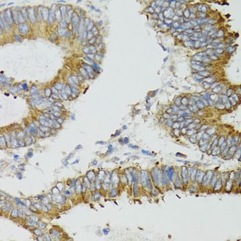 Immunohistochemistry - ND5 antibody (144-08135)
