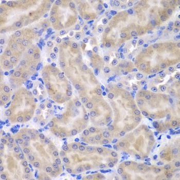 Immunohistochemistry - ASPSCR1 Polyclonal Antibody (144-07481)