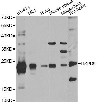 Western blot - HSPB8 antibody (144-02514)