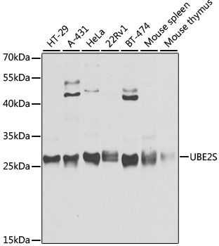 Western blot - UBE2S antibody (144-04658)