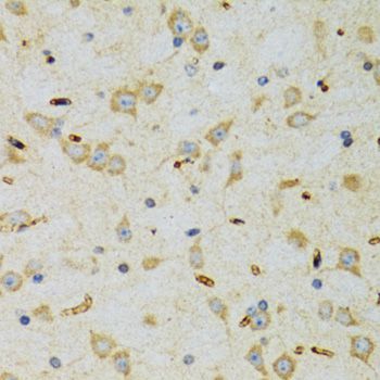 Immunohistochemistry - SRP19 Polyclonal Antibody (144-06752)