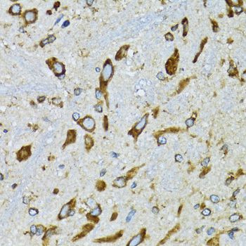 Immunohistochemistry - RPN1 antibody (144-600827)