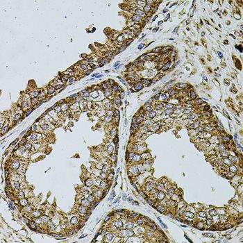 Immunohistochemistry - UQCRC1 antibody (144-03339)