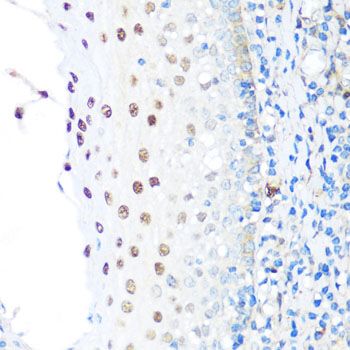 Immunohistochemistry - NAMPT Polyclonal Antibody (144-00256)