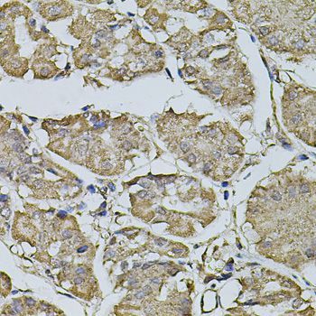 Immunohistochemistry - FDX1 antibody (144-09815)