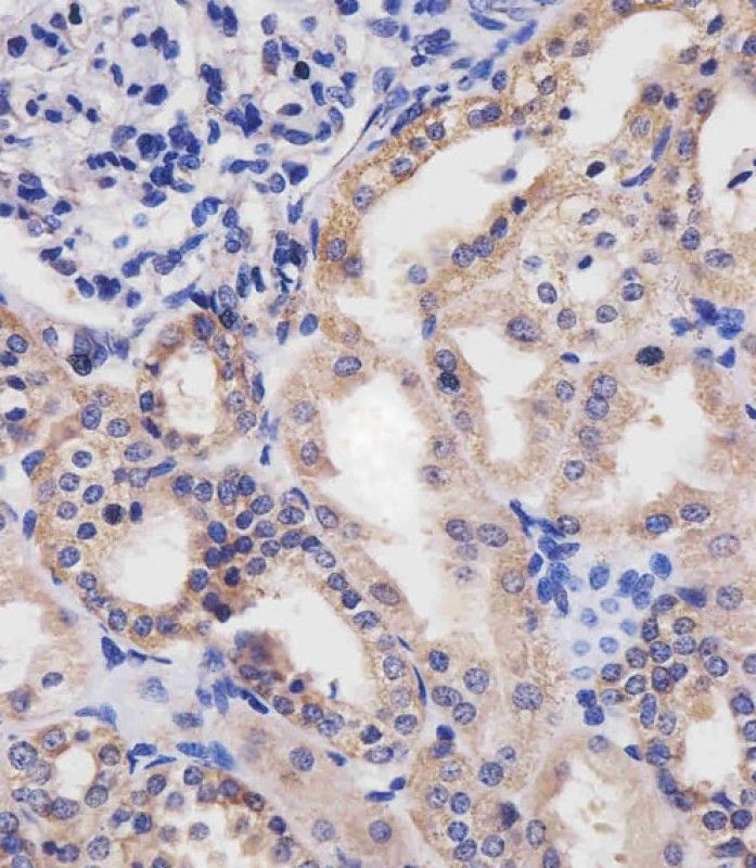 IHC-P