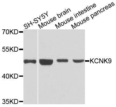 Western blot - KCNK9 antibody (144-12583)