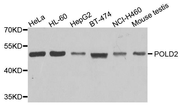 Western blot - POLD2 antibody (144-06834)