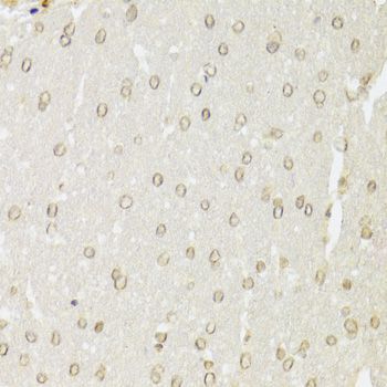 Immunohistochemistry - XRCC6 Polyclonal Antibody (144-00883)