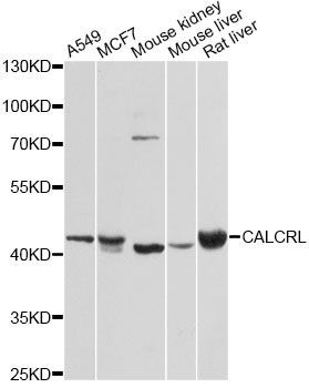 Western blot - CALCRL antibody (144-08533)