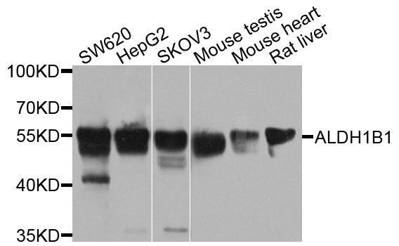 Western blot - ALDH1B1 antibody (144-03725)