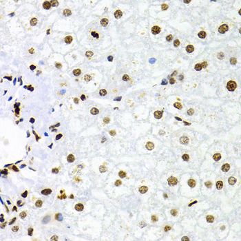 Immunofluorescence - NFKB2 Polyclonal Antibody (144-03108)