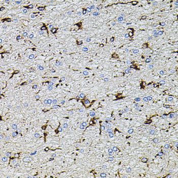 Immunohistochemistry - TRPA1 Polyclonal Antibody (144-08568)
