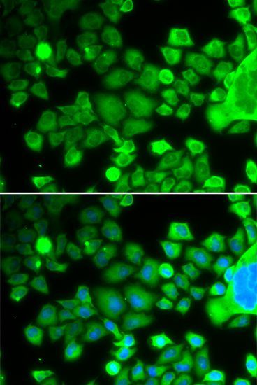 Immunofluorescence - RPS10 antibody (144-06056)