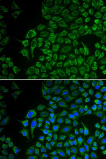 Immunofluorescence - TYR Polyclonal Antibody (144-01254)